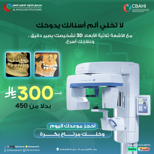 أشعة ثلاثية الابعاد 3D