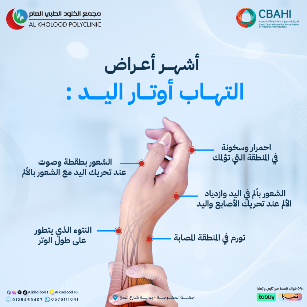التهاب اوتار اليد