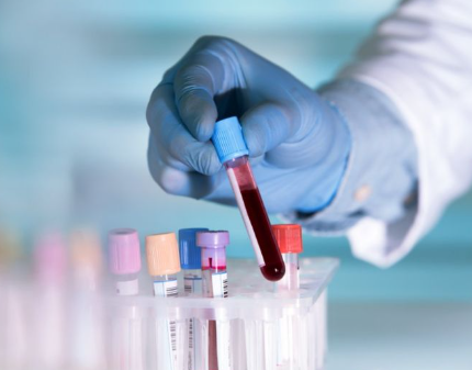 بكج تحليل الروكتان