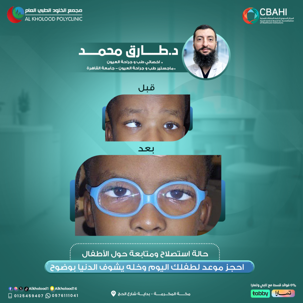 الحول ما يروح من نفسه !