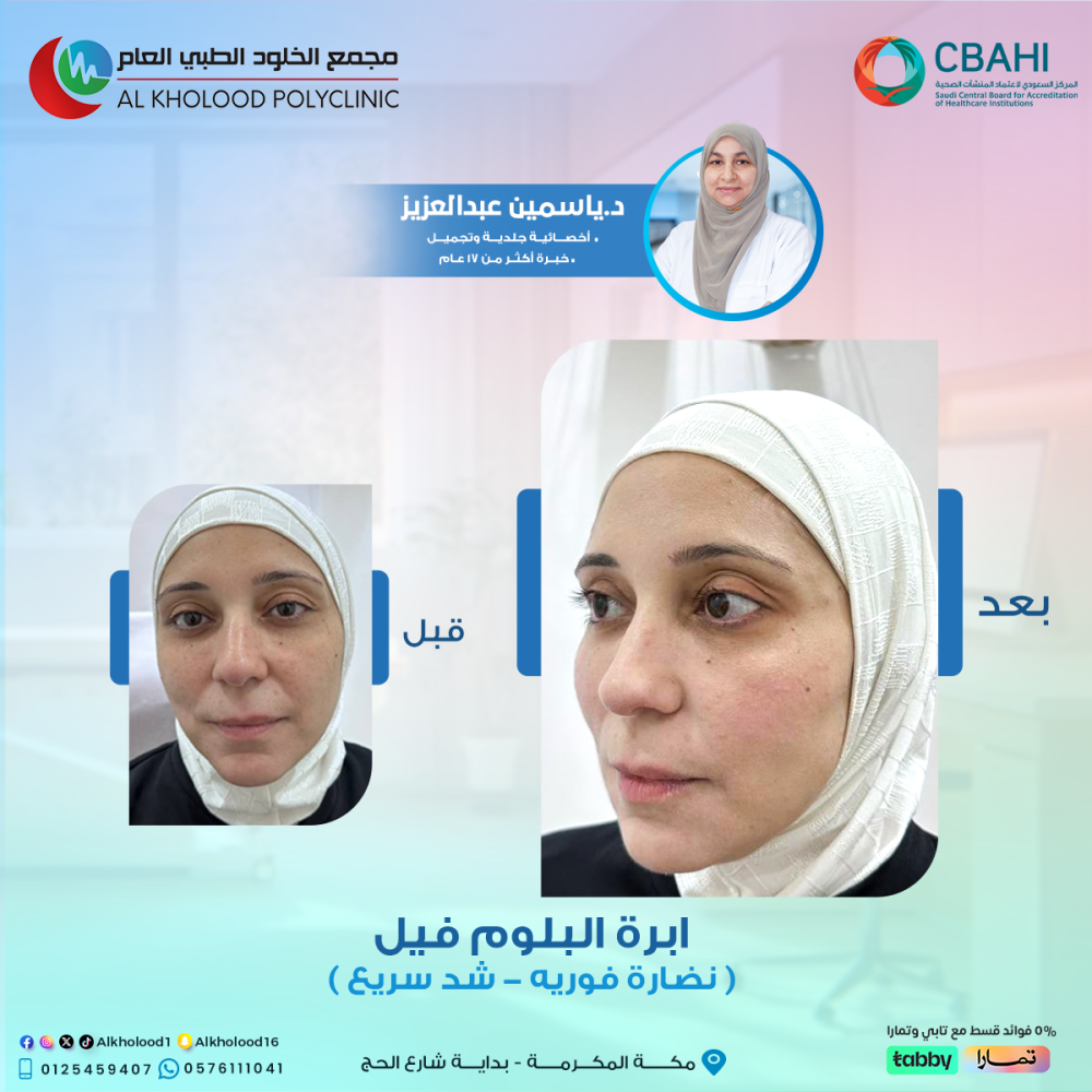 جلسة النضارة الفورية و الشد السريع ‍♀️