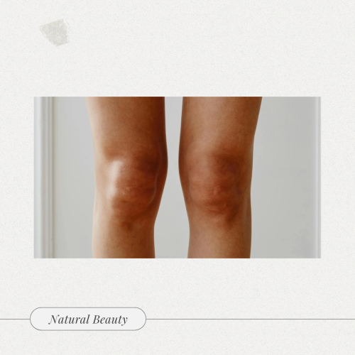 جلسة تصبغات ركبتين | Knee pigmentation session