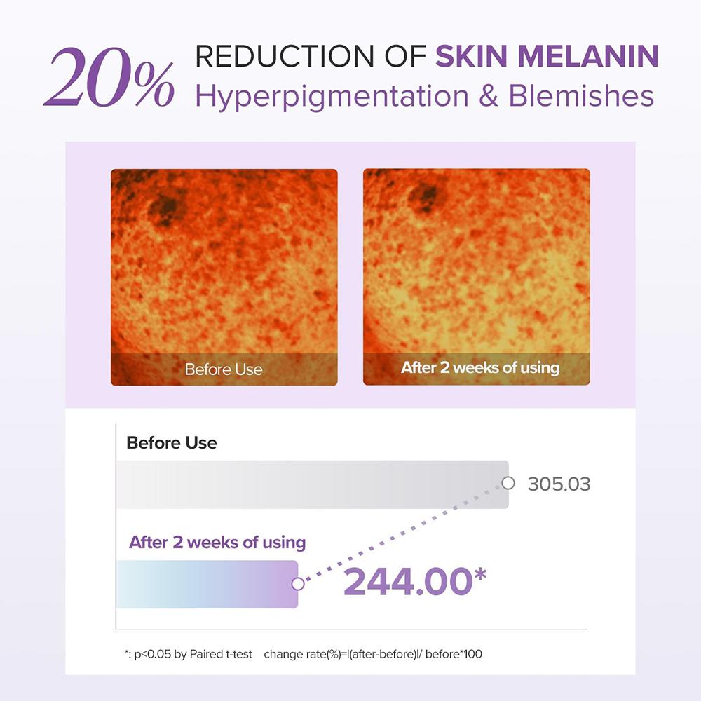 tranexamic acid vs glutathione for skin whitening Mary & May, Tranexamic Acid + Glutathione Brightening Eye Cream, Targets  Dark Circles & Dullness - 30 gm