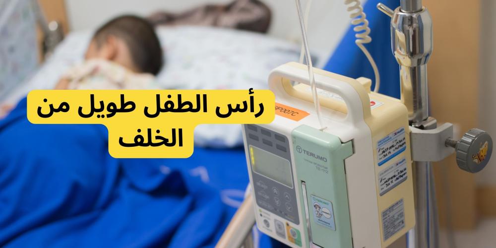 رأس الطفل طويل من الخلف