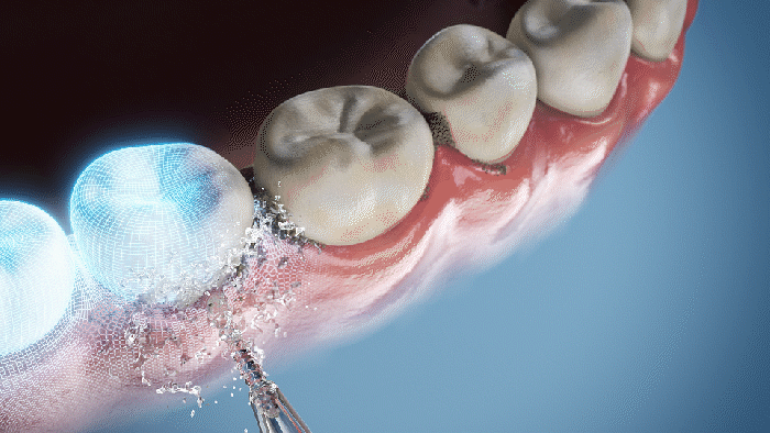 Zahnseide mit Wasser zur Zahnreinigung - اورسلا ursla