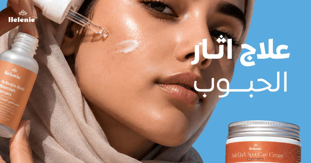 علاج اثار الحبوب