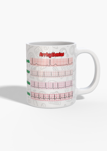 كوب تخطيط القلب (ECG Arrhythmias)