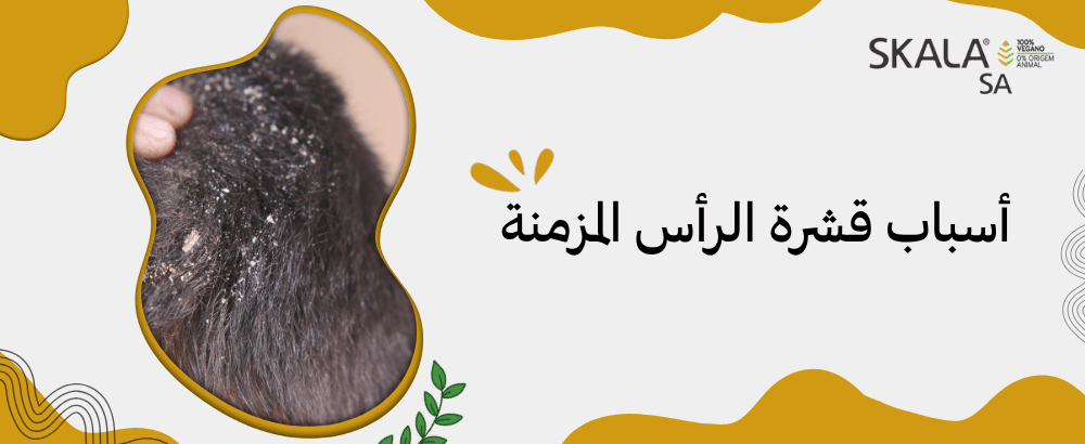 أسباب قشرة الرأس المزمنة