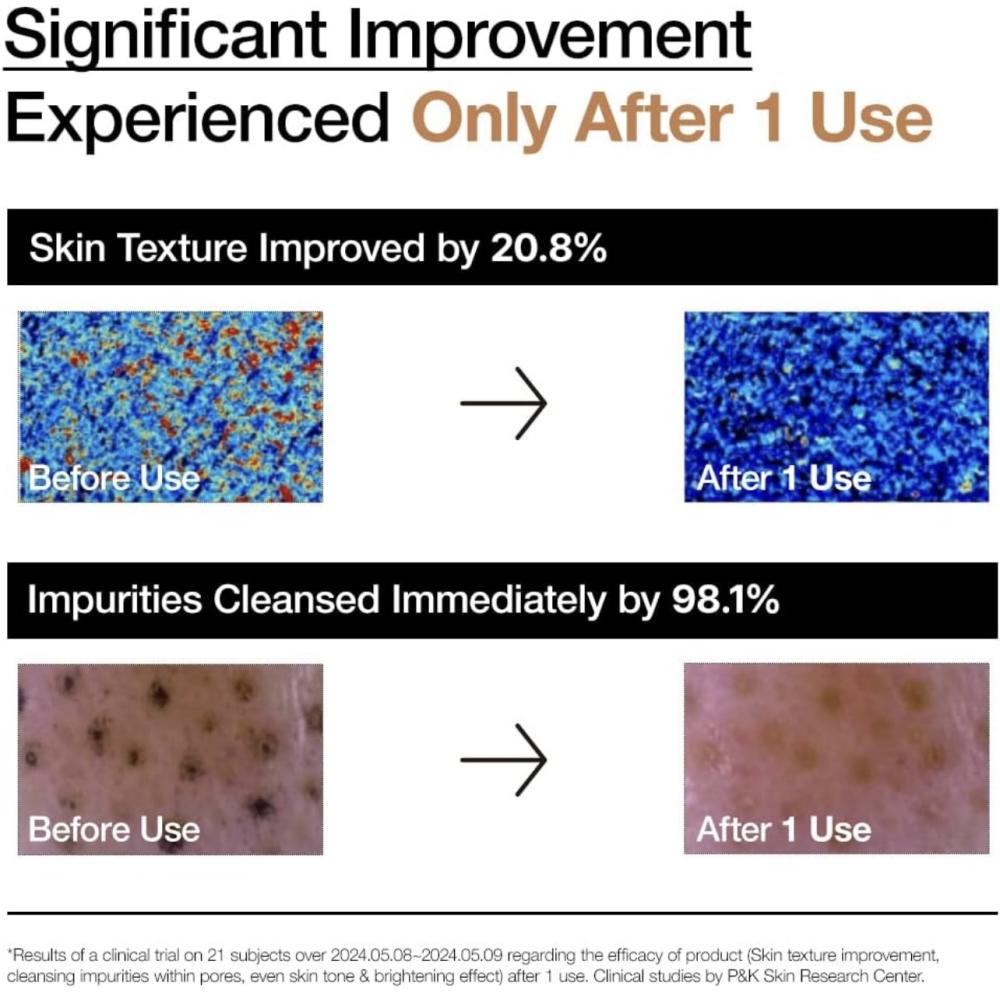 انوا - مسحوق تنظيف وتفتيح بإنزيم الأرز 40جرام