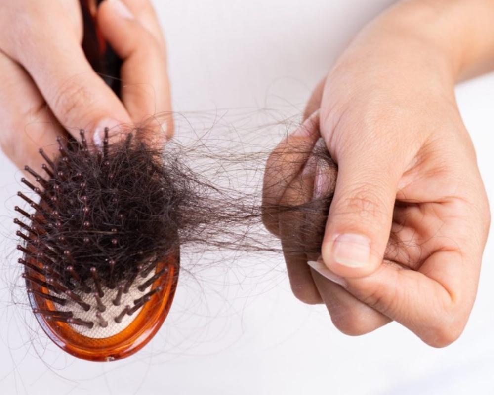 أسباب تساقط الشعر - حلولها