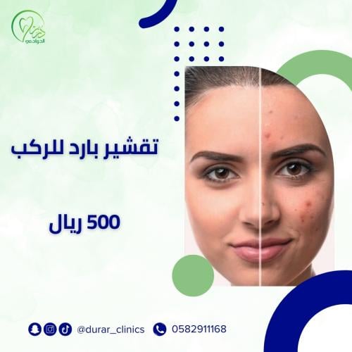 تقشير بارد للركب