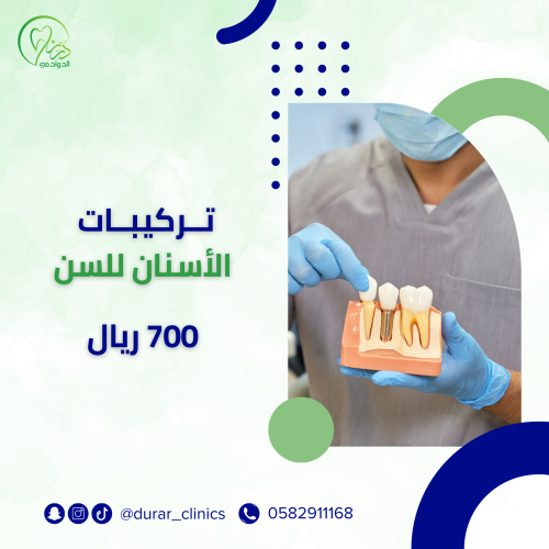 تركيبات الأسنان