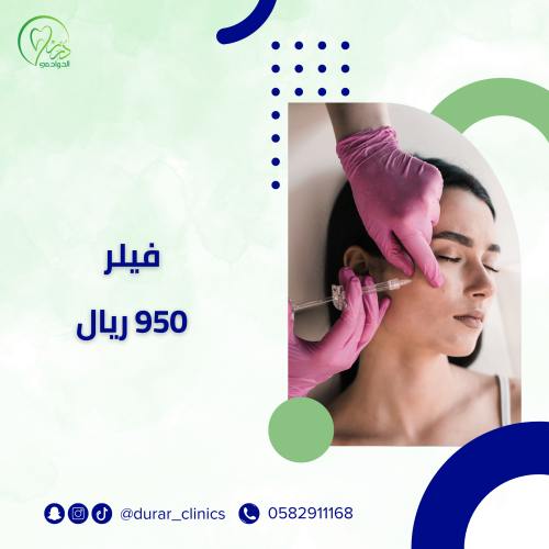 فيلر