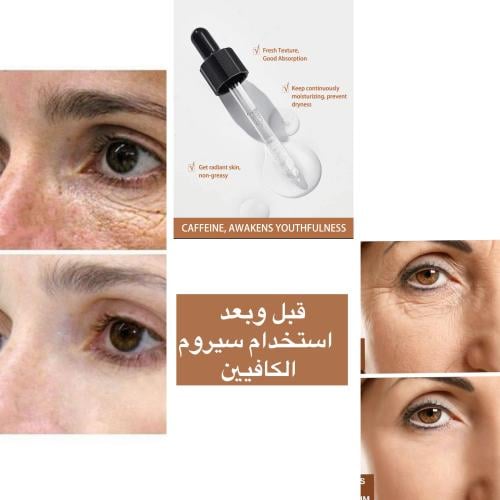 سيروم الكافيين لإزالة التصبغات