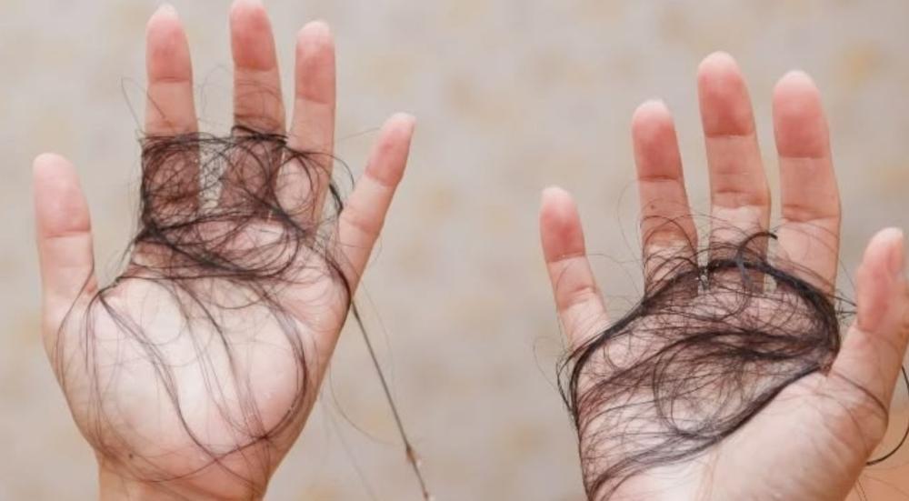 أسباب تساقط الشعر