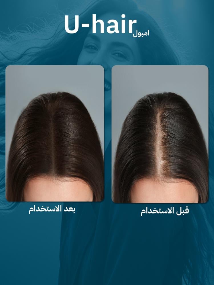 يو هير امبول U Hair Ampoule | أفضل علاج لتساقط الشعر وتكثيف الشعر من الجذور