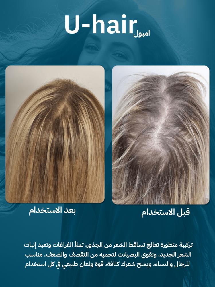 يو هير امبول U Hair Ampoule | أفضل علاج لتساقط الشعر وتكثيف الشعر من الجذور