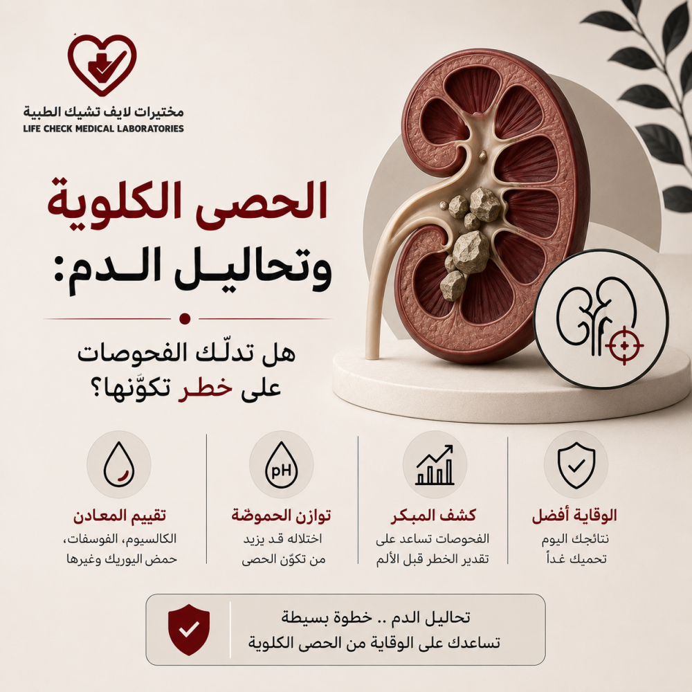 الحصى الكلوية وتحاليل الدم: هل تدلّك الفحوصات على خطر تكوّنها؟