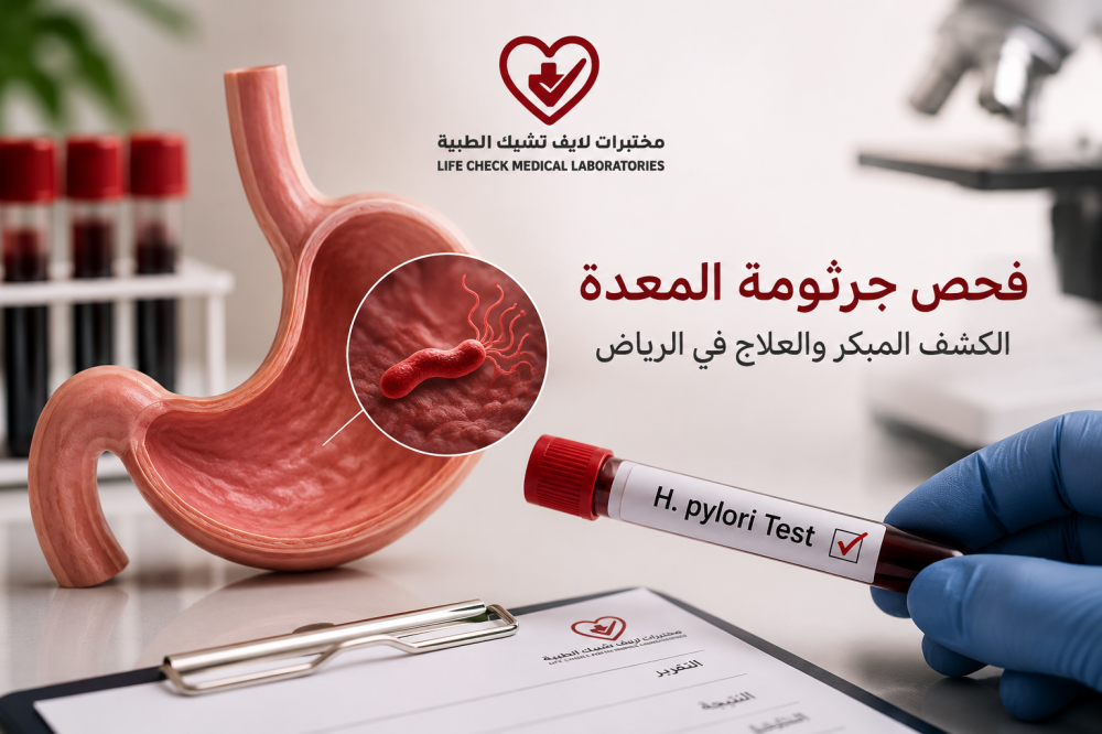 فحص جرثومة المعدة : الكشف المبكر والعلاج في الرياض