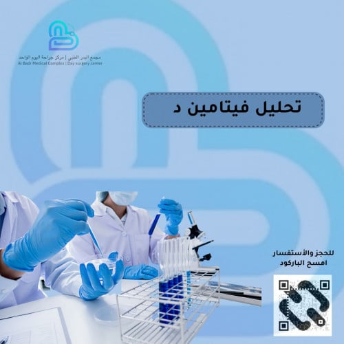 تحليل فيتامين D