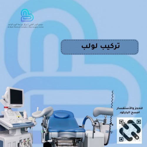 تركيب اللولب
