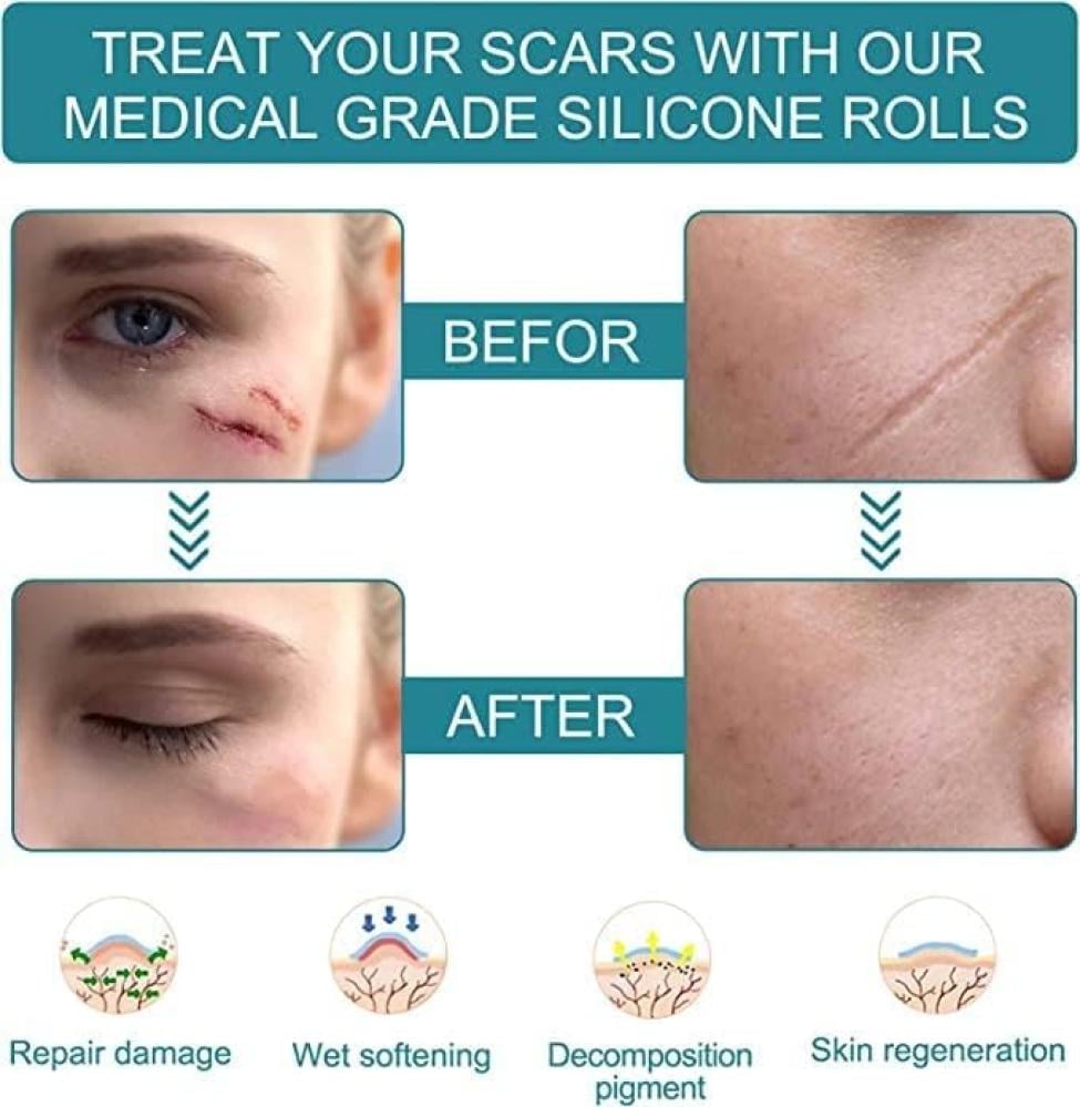 لفة شريط سيليكون لإزالة الندوب بي كير 1.6 إنش×60 إنش قابلة لإعادة الاستخدام