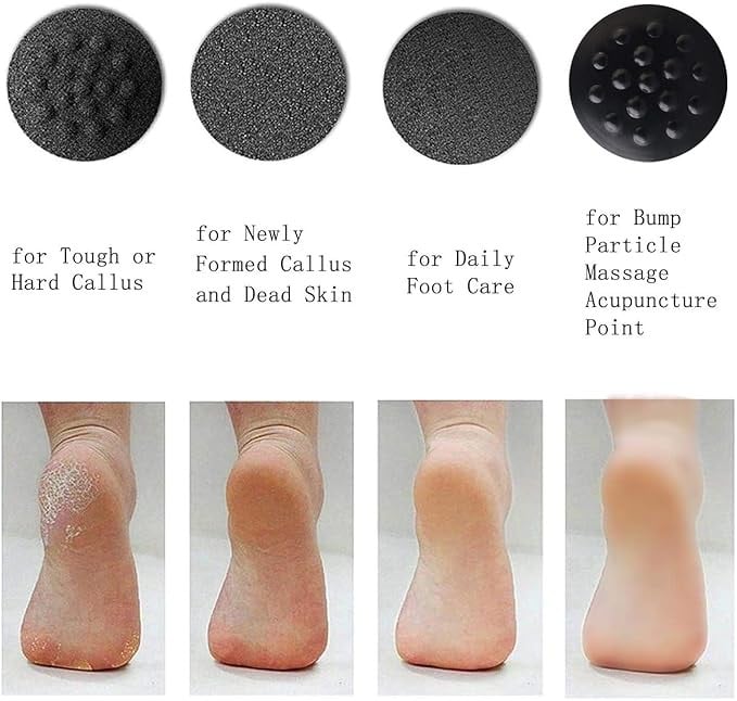 مزيل مسامير القدم الكهربائي قابلة لإعادة الشحن 4 بكرات