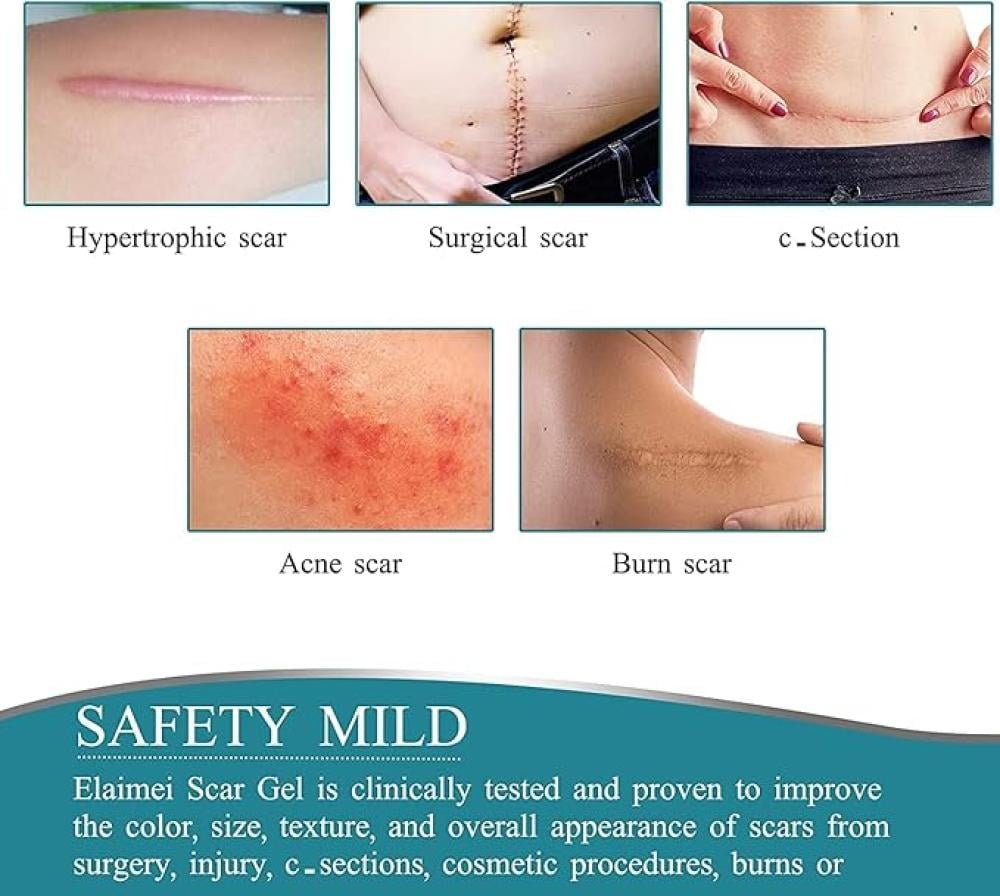 لفة شريط سيليكون لإزالة الندوب بي كير 1.6 إنش×60 إنش قابلة لإعادة الاستخدام