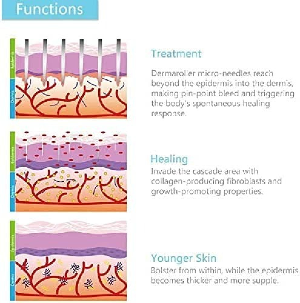 ديرما رولر 540 إبر تيتانيوم 0.20mm مقبض بلاستيكي مريح أسود ووردي
