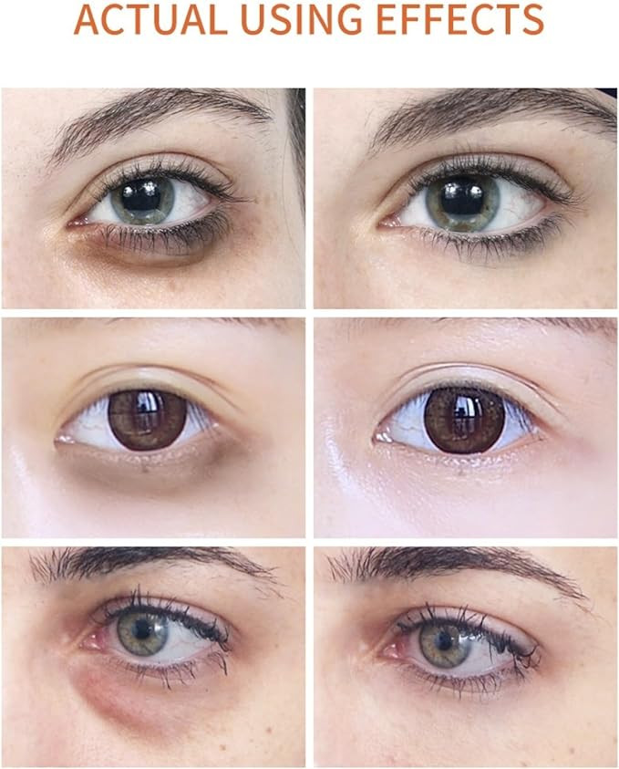 سيروم عين مرطب من BreyLee بخلاصة فيتامين C وبكرة دوّارة 15 مل