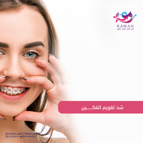 شد تقويم للفكين