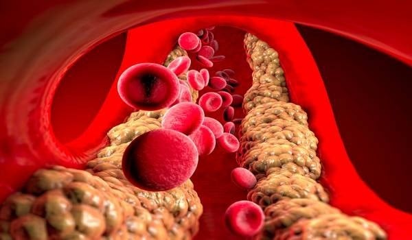 The best medicine for treating triglycerides and cholesterol