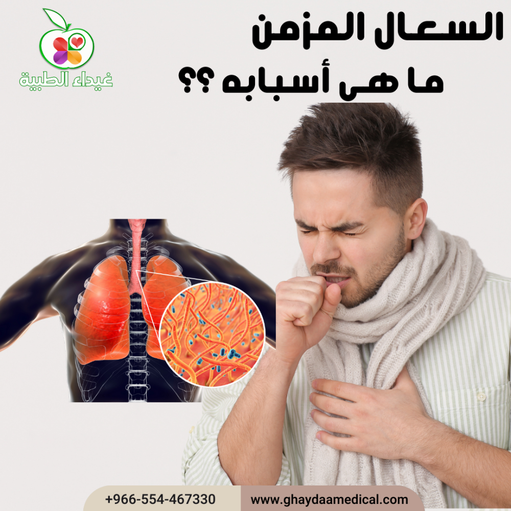 الأسباب المحتملة للسعال المستمر
