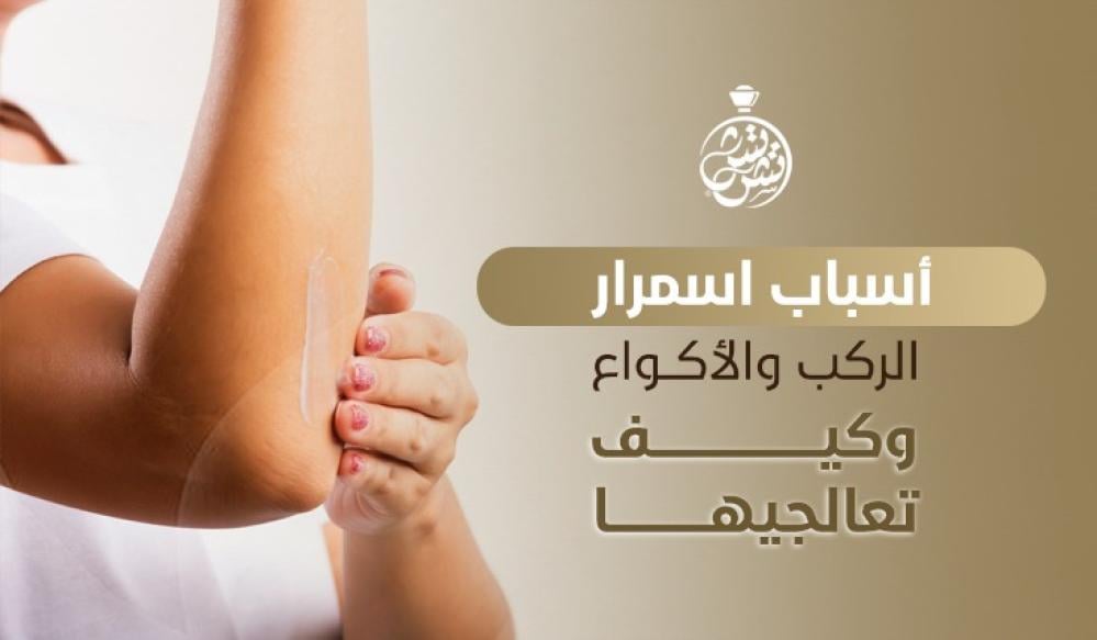 اسمرار الركب والأكواع – أسباب وعلاج