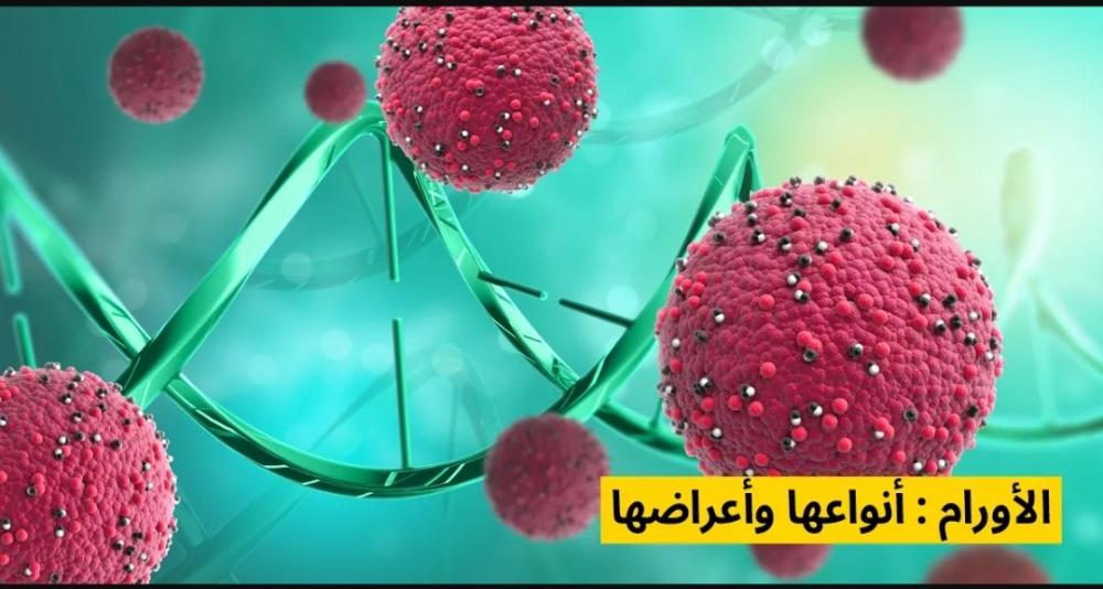 ماهي الأورام