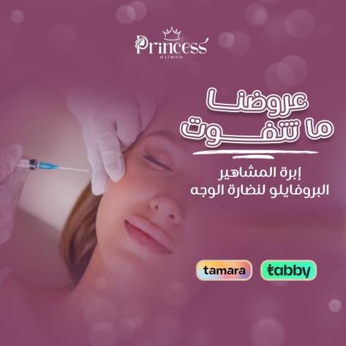 ابرة النضارة بروفايلو