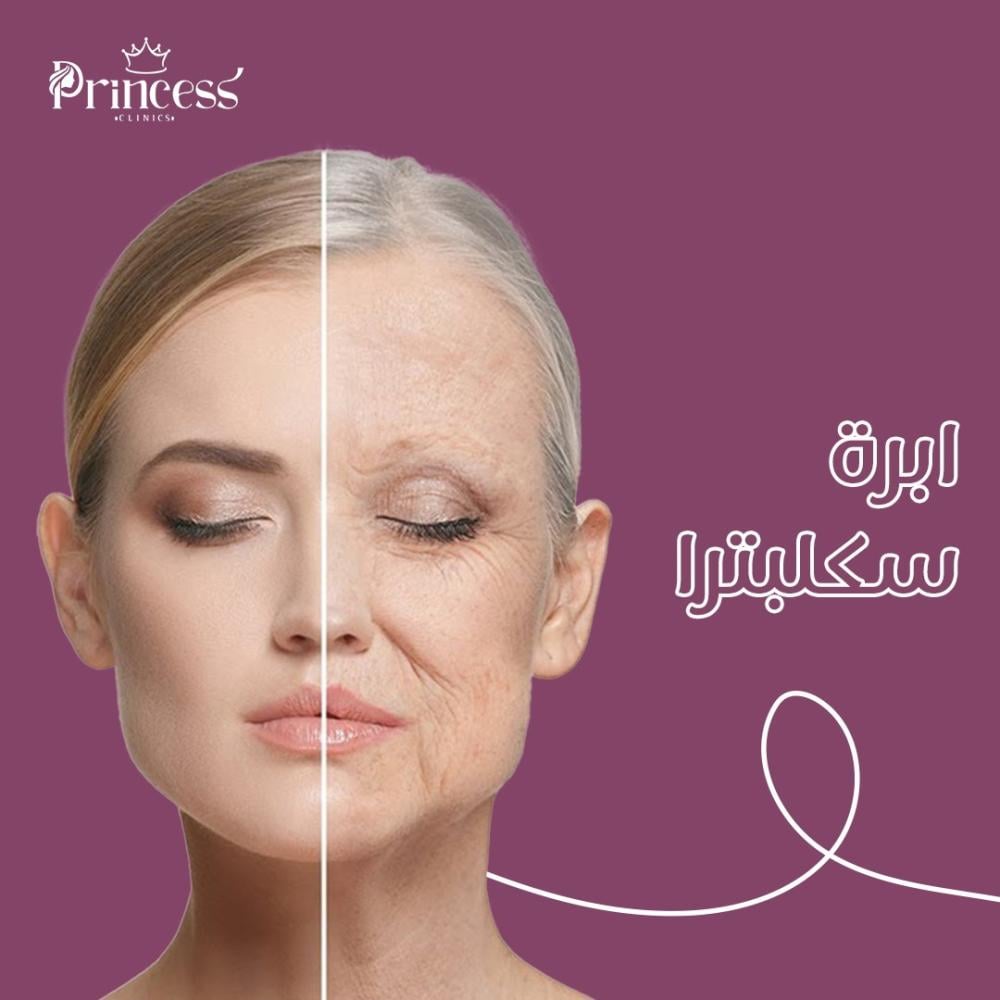حقن السكلبترا (Sculptra) لتجاعيد الوجه_ابر النضارة