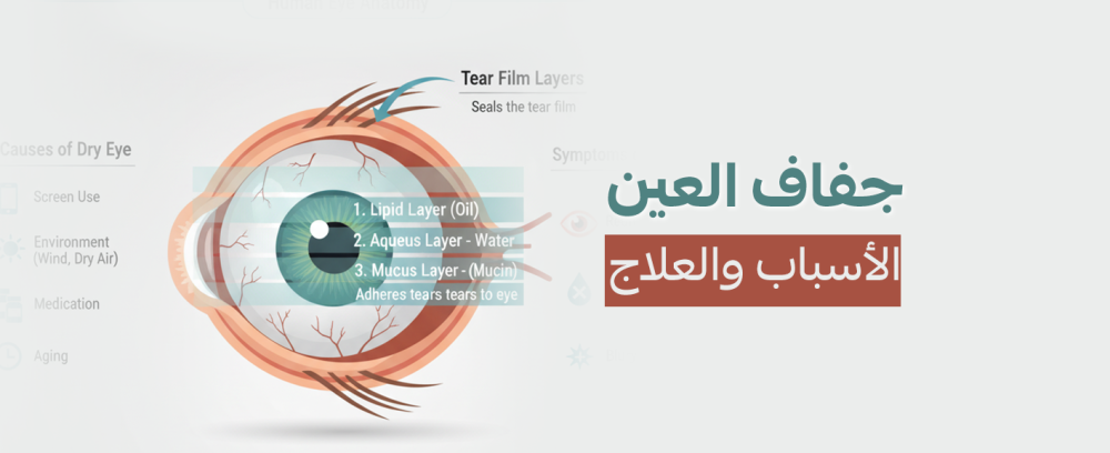جفاف العين: دليلك الشامل للتخلص من الانزعاج واستعادة الراحة