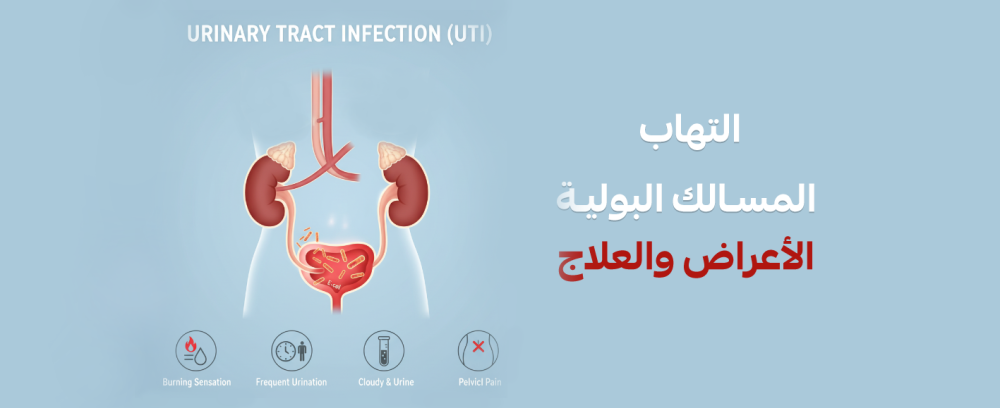 أعراض التهاب المسالك البولية وأفضل فوار لعلاجها بسرعة