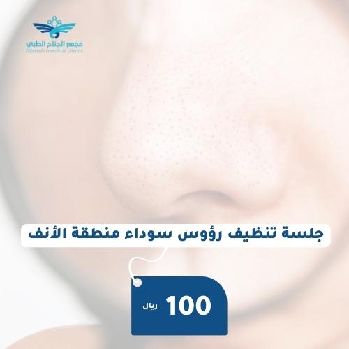 جلسة تنظيف رؤوس سوداء منطقة الانف