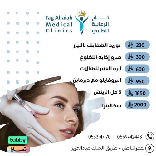 ابرة العنبر للهالات