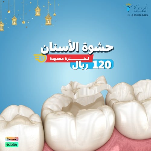 حشوة الاسنان