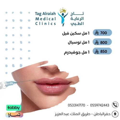 1 مل فيلر جوفيدريم