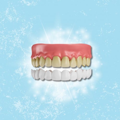 تبيض الأسنان المنزلي