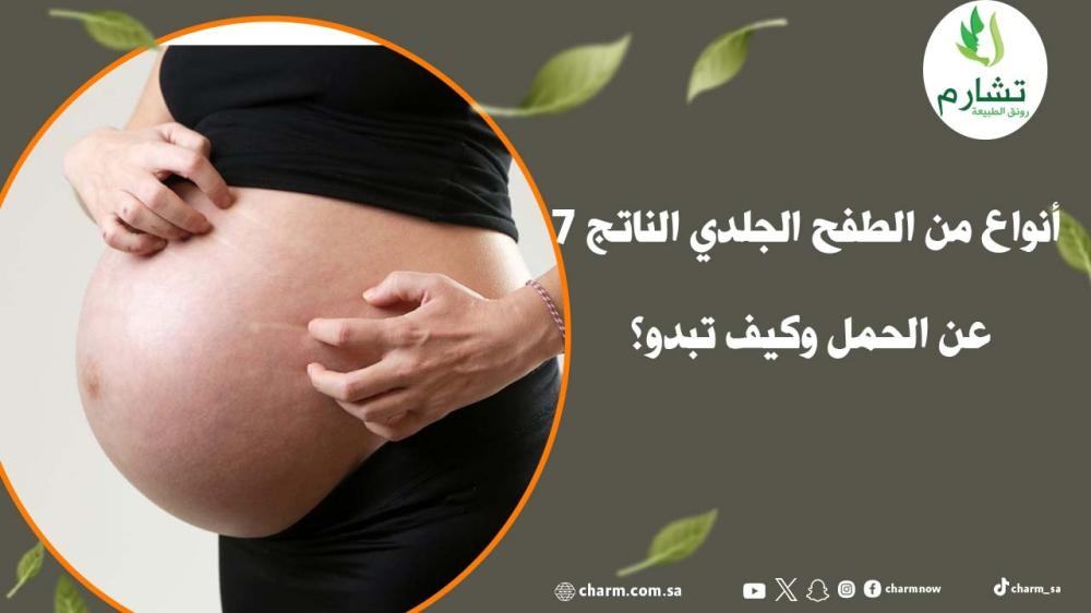 7 أنواع من الطفح الجلدي الناتج عن الحمل وكيف تبدو؟