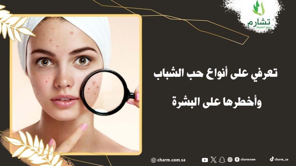 تعرفي على أنواع حب الشباب وأخطرها على البشرة