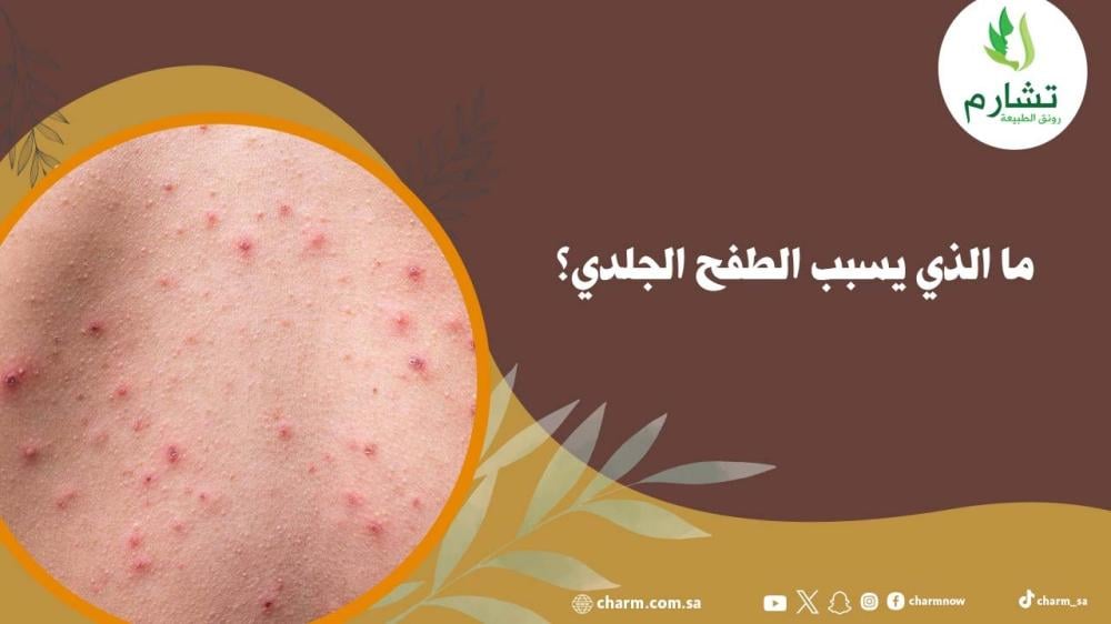 ما الذي يسبب الطفح الجلدي؟