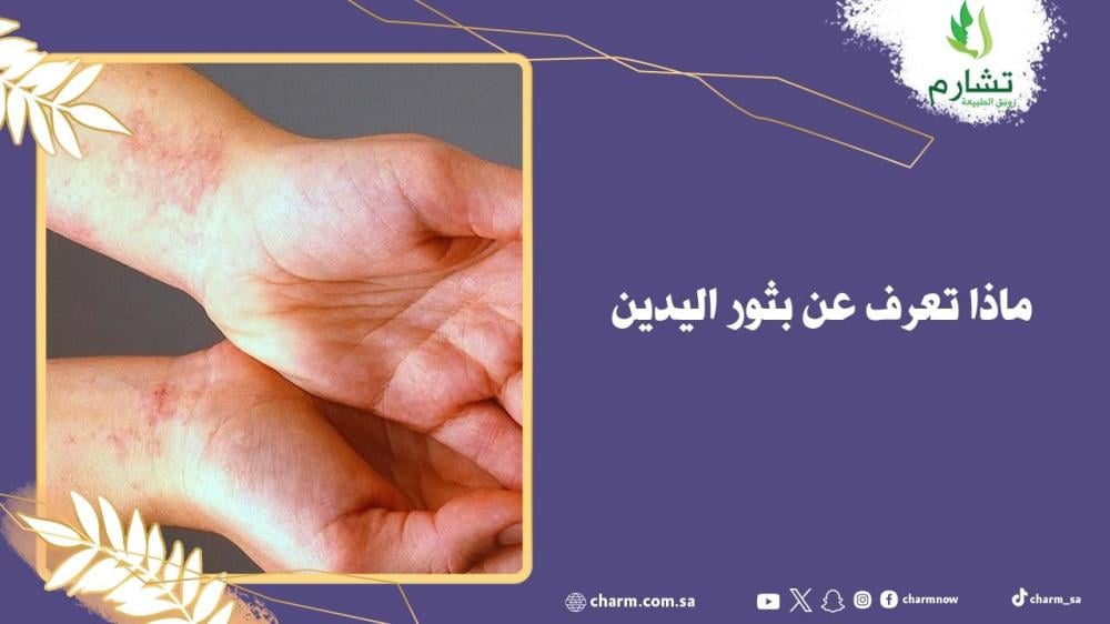 ماذا تعرف عن بثور اليدين