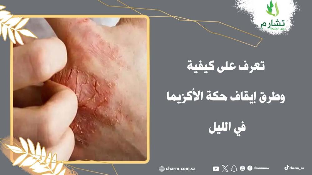 تعرف على كيفية وطرق إيقاف حكة الأكزيما في الليل