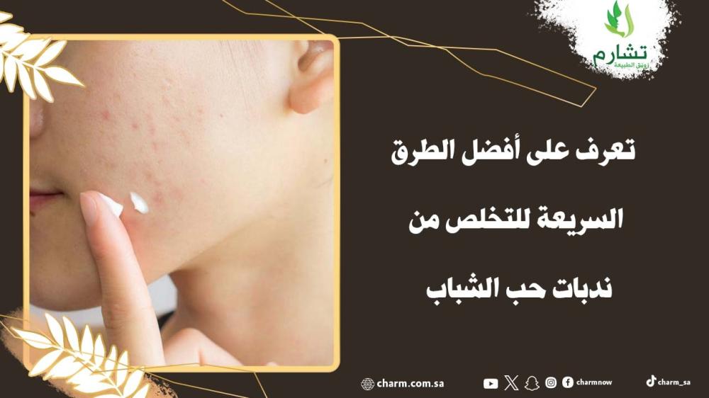 تعرف على أفضل الطرق السريعة للتخلص من ندبات حب الشباب